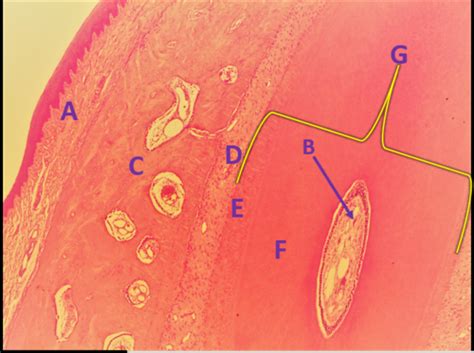 Digestive System: Wall; Peritoneum; Histology Flashcards | Quizlet