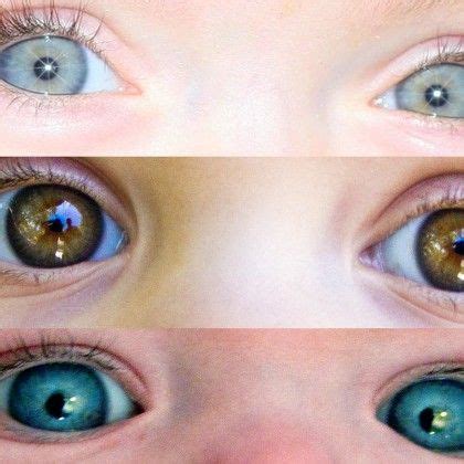 Baby Eye Color Change