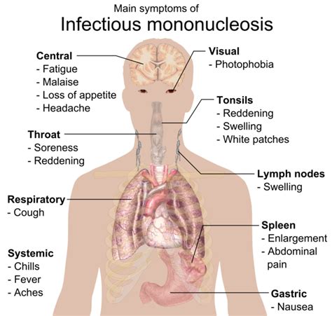 15.25B: Infectious Mononucleosis - Biology LibreTexts