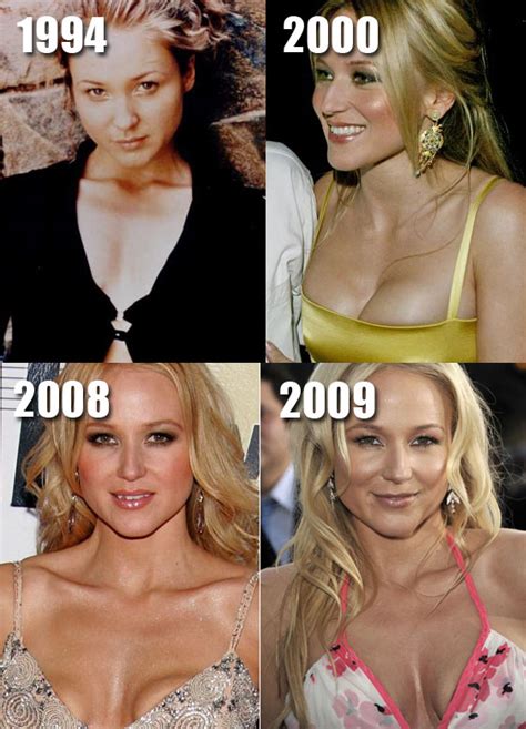 Jewel Plastic Surgery Before and After Breast Implants | Plastic Surgery