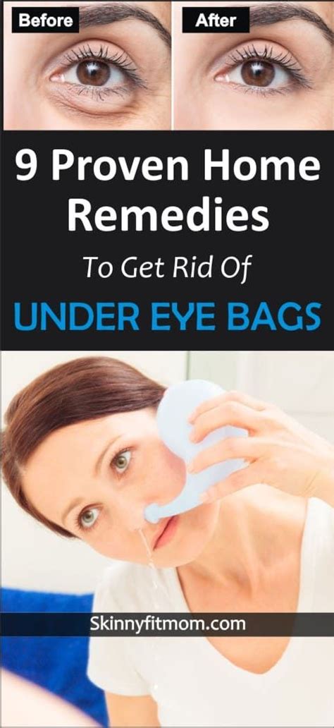 Learn how to get rid of under eye bag. These 9 home remedies are tested ...