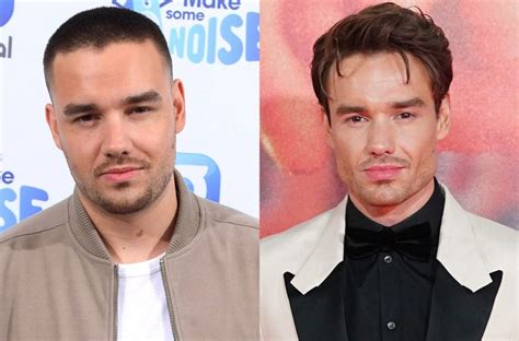 Did Liam Payne Undergo Buccal Fat Removal? Singer Shocks Fans With New ...