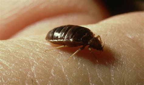 Signs of bed bug bites after warning ‘widespread’ Paris infestation could head to London - Sound ...