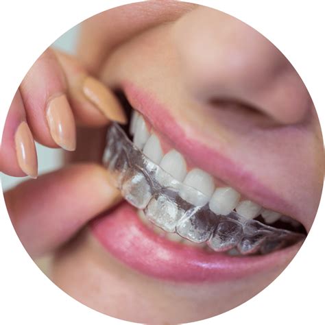 What are Invisalign Braces | Pitner Orthodontics