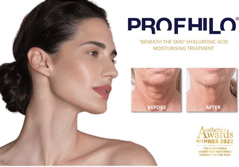 Profhilo® Skin Moisturising Treatment - Age Repair