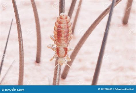 A head louse stock illustration. Illustration of disease - 162296088