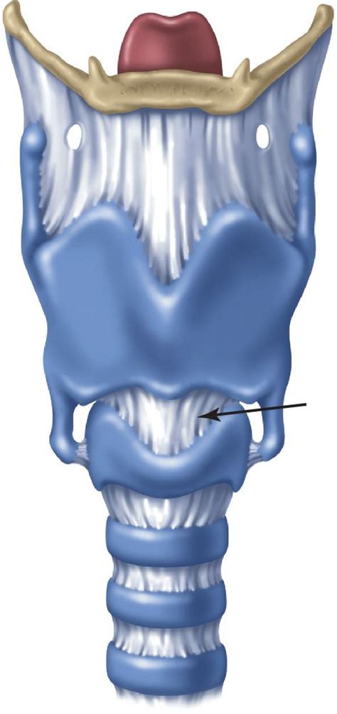 Cricothyroidotomy—Standard and Needle | Anesthesia Key