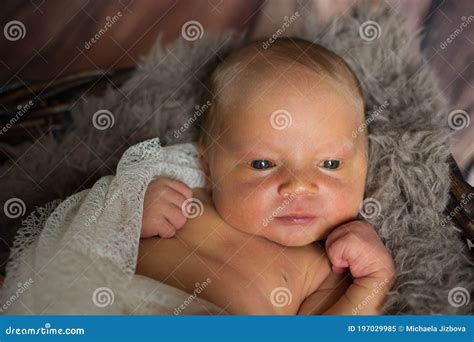 Neonatal Jaundice - Yellowish Of The Skin In Newborn Baby Royalty-Free Stock Photography ...