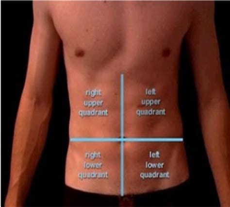 Doctors Network: Gallstones