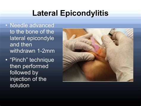 Corticosteroid injections in Orthopaedics