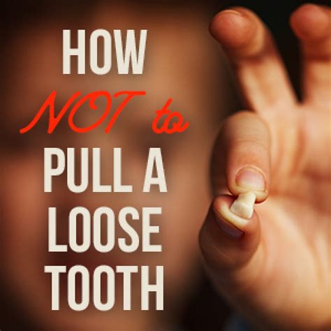 How To Keep A Loose Permanent Tooth From Falling Out at Lois Blackmon blog