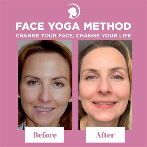 Face Yoga Method / 5 Best Face Yoga Exercises Top Facial Exercises ...