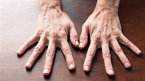 Hand Exercises for Rheumatoid Arthritis (RA) Relief | Everyday Health