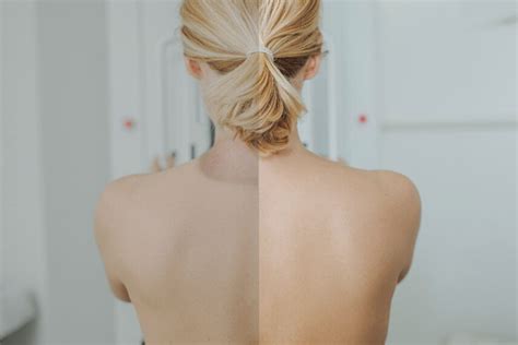 How to Lose Fat From Back of Neck -15 Natural Ways