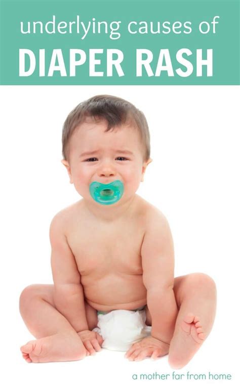 Pin by Rajangam on Baby | Baby diaper rash, Rash causes, Diaper rash