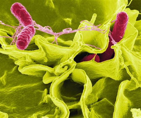 Bacterial Infections of the Gastrointestinal Tract | Microbiology