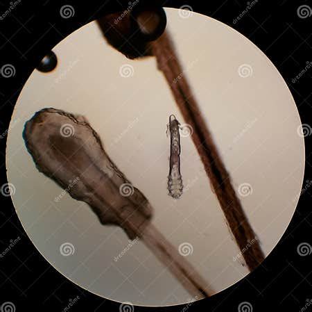Demodex Folliculorum - Parasitic Mite on the Eyelashes of a Human Eye Stock Image - Image of ...