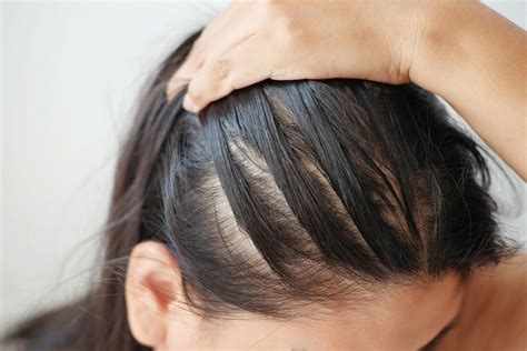How To Tell If Your Hair Is Thinning & 7 Things That Can Help