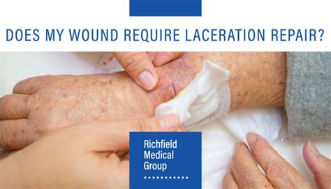 Does My Wound Require Laceration Repair?