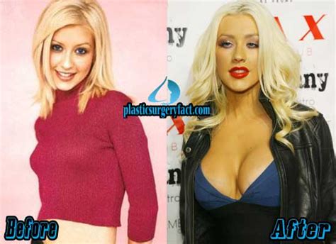 Christina Aguilera Plastic Surgery Before and After Photos