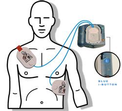 How to use an Automated External Defibrillator (AED) — Save-A-Life ...