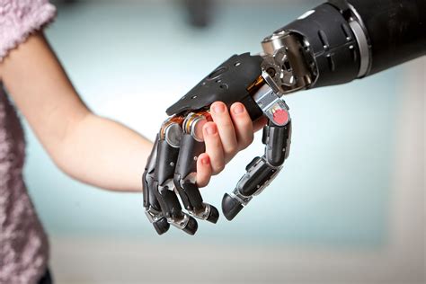 A Prosthetic Arm That Gives Amputees the Sense of Touch - Bloomberg