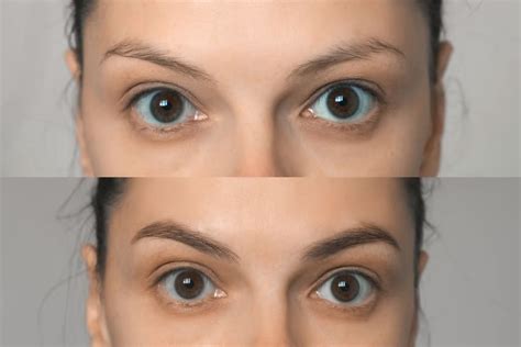 What Are the Best Eyebrow Treatments to Enhance Your Look? | Elithair