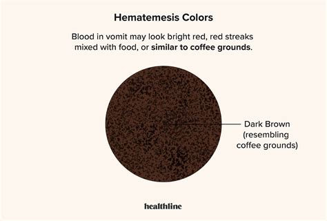 Hematemesis Causes