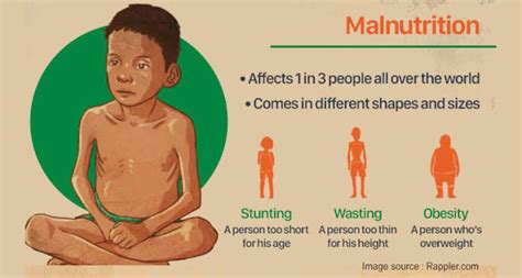 Malnutrition- Threat to Your Wellness | HealthGist.Net