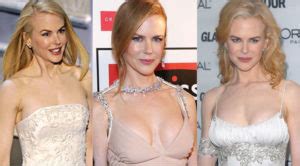 Nicole Kidman Plastic Surgery Before and After Pictures 2024