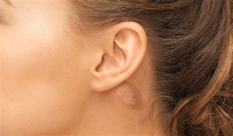 What You Need To Know About That Lump Behind Your Ear - CureJoy