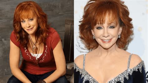 Reba McEntire Plastic Surgery Secrets: Fact or Fiction? | PlasticSurgeryInsights.com