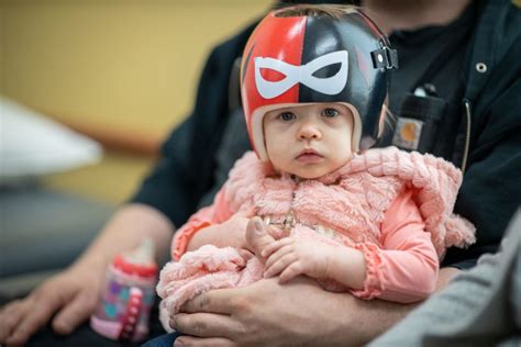 Treating flat head syndrome with a helmet - Hamilton Health Sciences