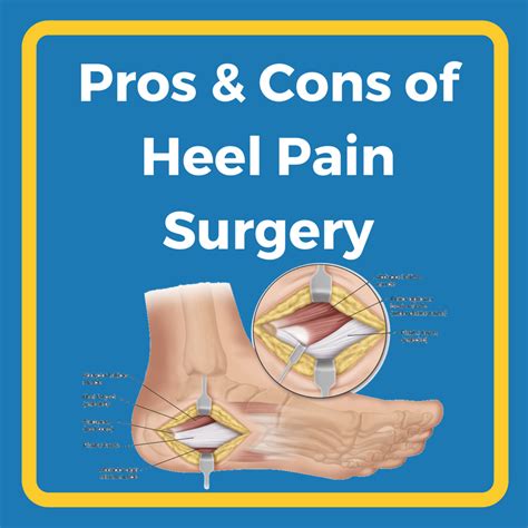 Pros & Cons of Heel Pain Surgery | Heel That Pain