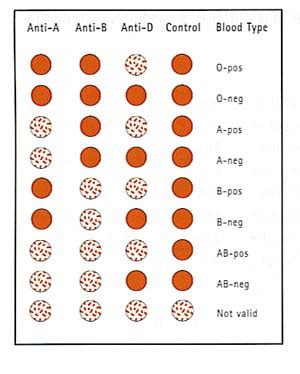 aravind's blog: blood groups and there testing