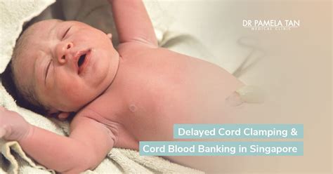 Delayed Cord Clamping & Cord Blood Banking in Singapore - Dr Pamela Tan