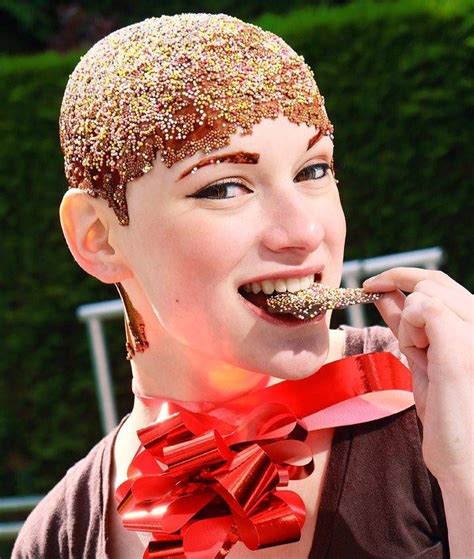 Alopecia sufferer becomes chocolate egghead to highlight hair loss disease... #Easter Hair Loss ...