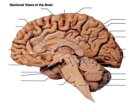 Brain, Sagittal Section Diagram | Quizlet