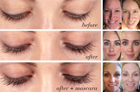 20 Rodan and Fields Before and After Pictures That Will Shock You - The ...