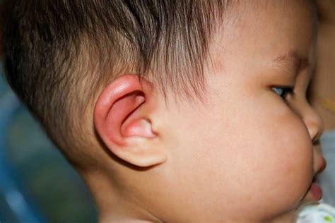 How To Know If I Have an Ear Infection? 10 Ear Infection Symptoms