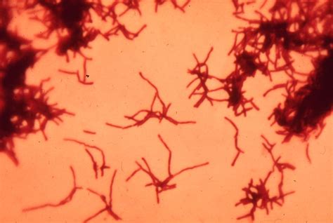 b122-2 Actinomyces israelii. Gram stain broth culture - a photo on ...