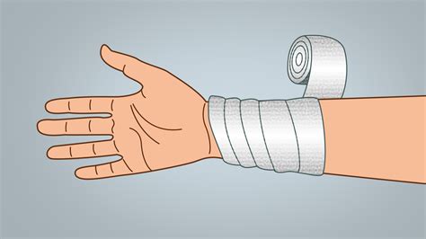 Bandage Wrapping Techniques - Wellness Keen