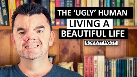 Meet Robert Hoge, the ‘Ugly’ Human Living a Beautiful Life - YouTube