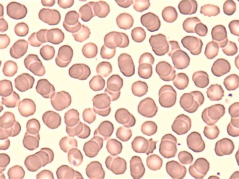 Erythrocytes