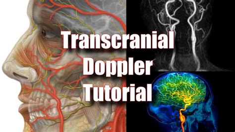 Transcranial Doppler – Sonographic Tendencies