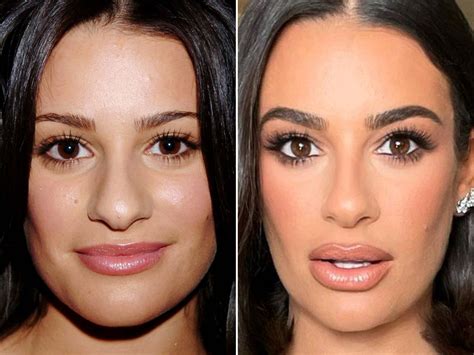 Lea Michele Before and After: From 2006 to 2022 - The Skincare Edit