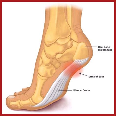 Foot Pain Chart