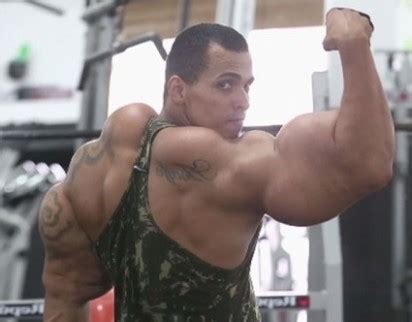 Synthol Profile and Use in BodyBuilding – Bodybuilding Community Forum