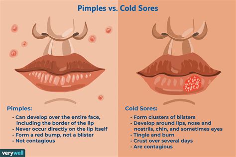 Cold Sore vs. Pimple: How to Tell the Difference