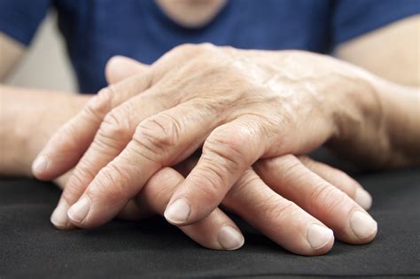 What You Need to Know About Rheumatoid Arthritis Symptoms and Treatment ...